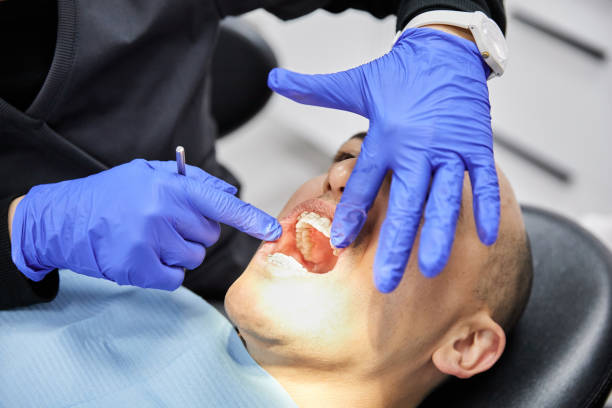 Best Root Canal Emergency Dentist  in City View, SC